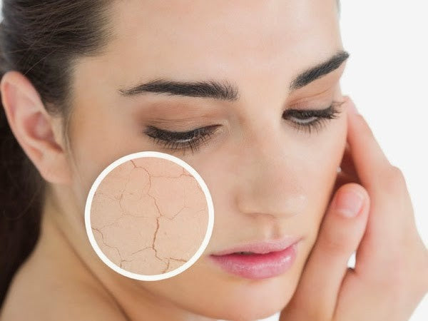How to Treat Dry Skin on Face